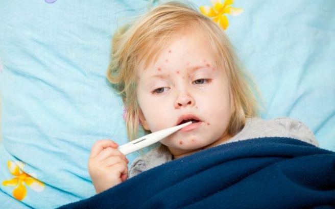 Τι συνιστά για την ιλαρά η Ελληνική Παιδιατρική Εταιρεία