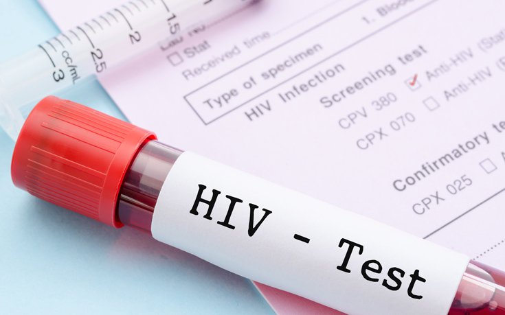 Λιγότερες νέες διαγνώσεις του ιού HIV τα τελευταία χρόνια 1