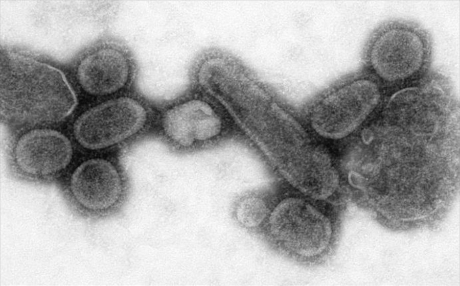 Ο ιός της εποχικής γρίπης είναι «εγγονάκι» της ισπανικής γρίπης 1
