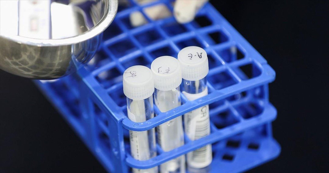 PCR τεστ μπορούν να ανιχνεύσουν έγκαιρα και τον καρκίνο της μήτρας