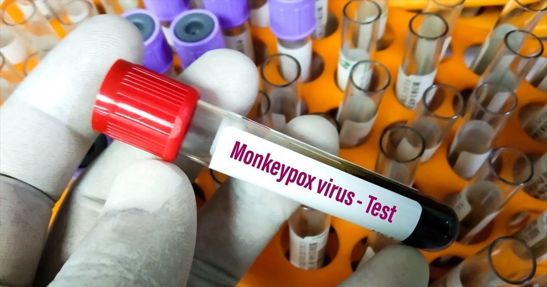 Ποιες σοβαρές νευρολογικές επιπλοκές εμφανίζουν κάποιοι ασθενείς